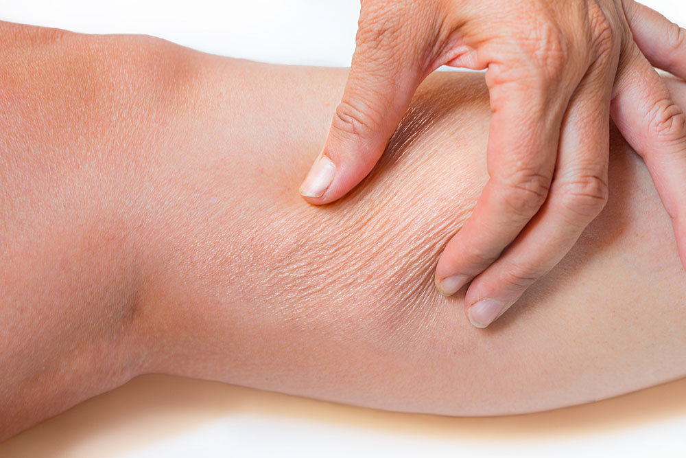 Indiba Leg Treatment