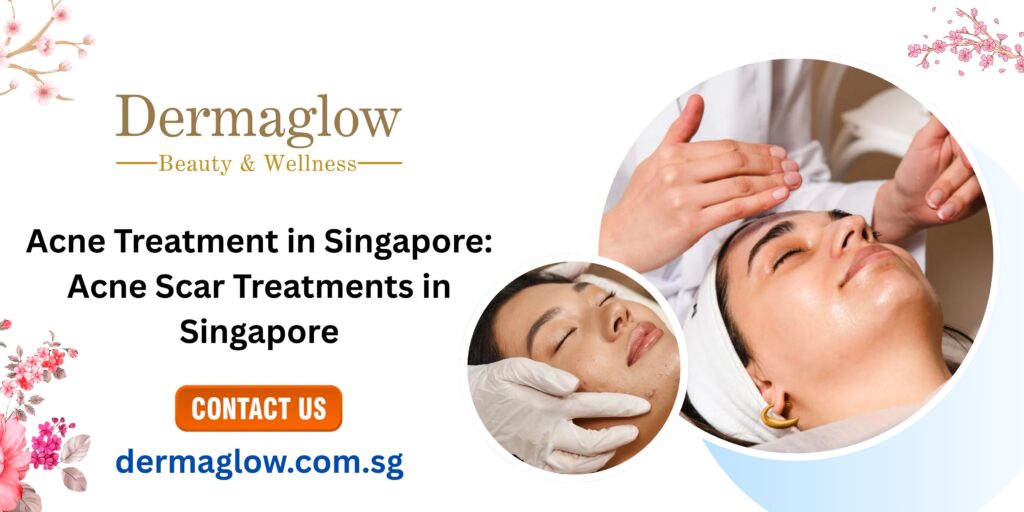 Acne Treatment in Singapore